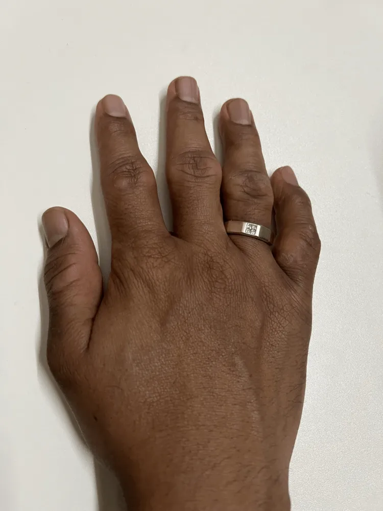 関節の状態やタイピングの悩みを説明する図解